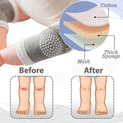 Baby Crawling Anti-Slip Knee pads (Grey)