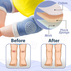 Baby Crawling Anti-Slip Knee pads (Blue)