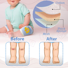 Baby Crawling Anti-Slip Knee pads (Sky Blue)